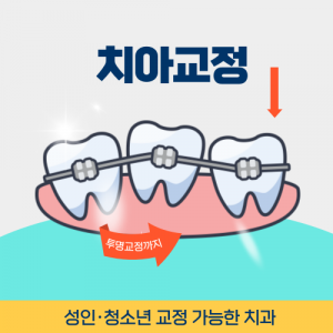 신촌치과 신촌역치과 치아교정
