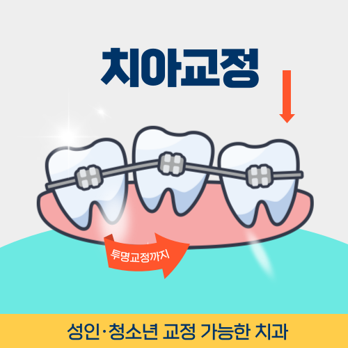 신촌치과 신촌역치과 치아교정