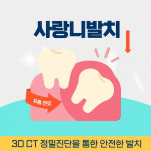 신촌치과 신촌역사랑니발치