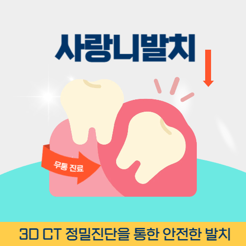 신촌치과 신촌역사랑니발치