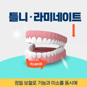 신촌치과 신촌역틀니 라미네이트